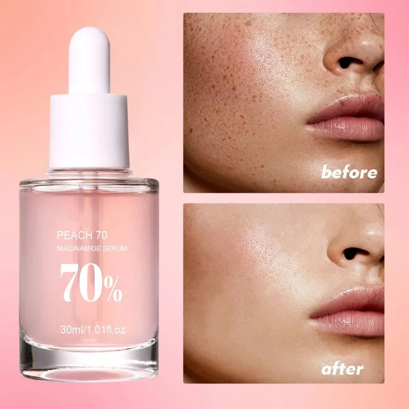 Peach Niacinamide Serum